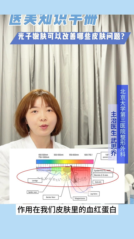 光子嫩肤能改善哪些皮肤问题？