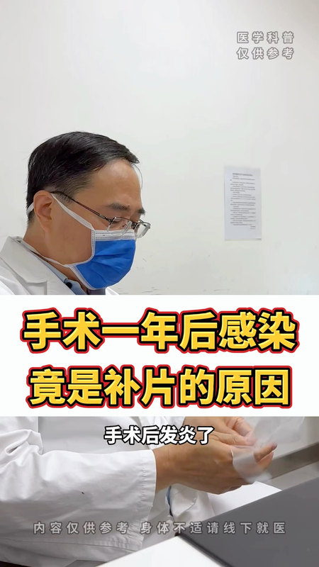 术后一年切口感染竟是补片的原因
