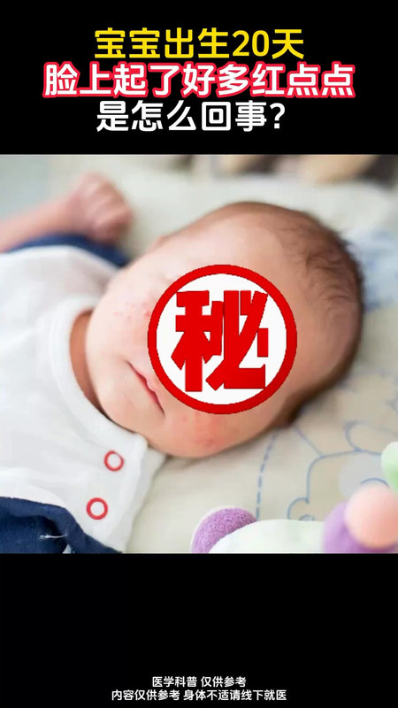 宝宝出生20天，脸上有很多红点点怎么办？
