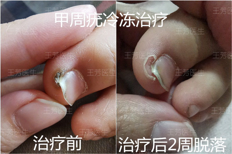 圖文圖片