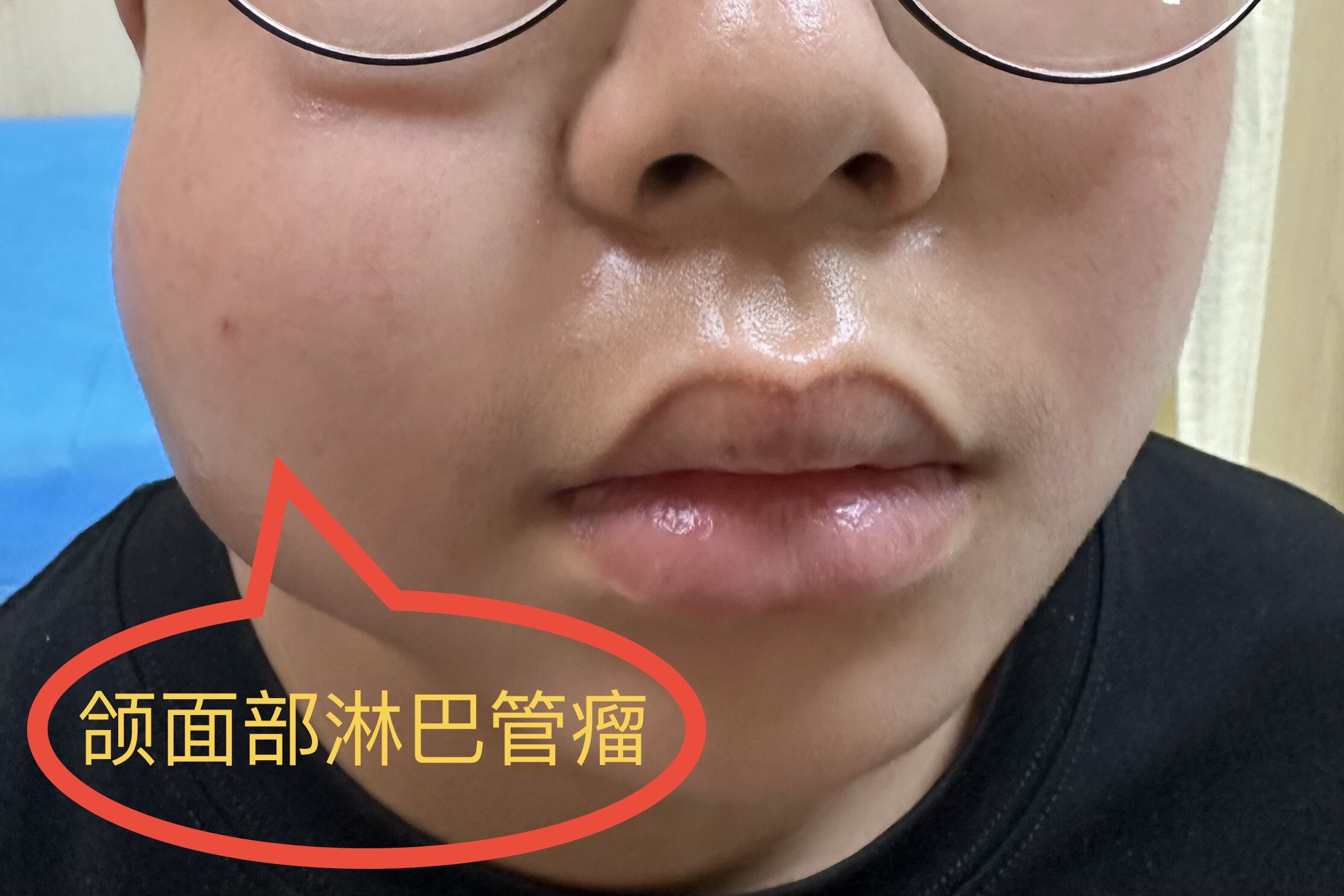 圖文圖片