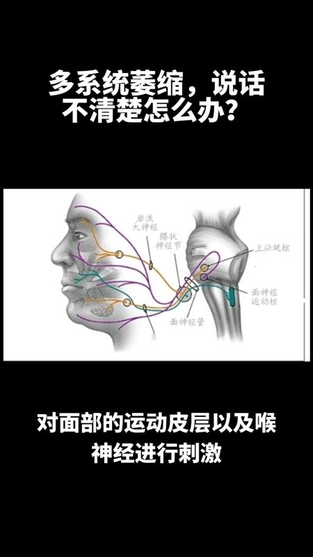 視頻封面