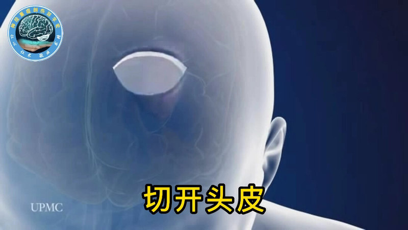 脑出血手术怎么做