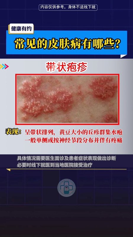 視頻封面