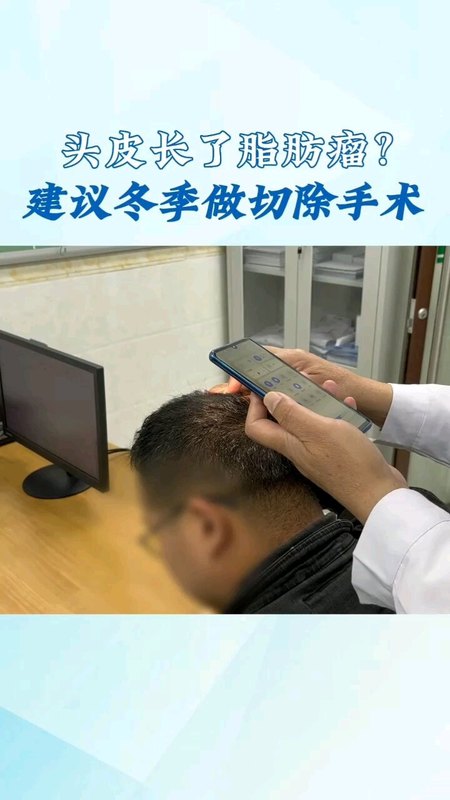 头皮长了脂肪瘤，建议冬季做切除手术