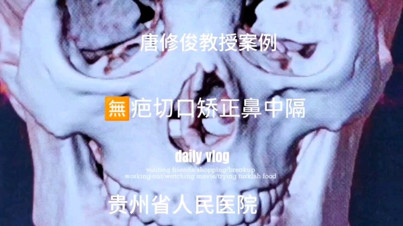 視頻封面