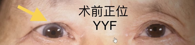 圖文圖片