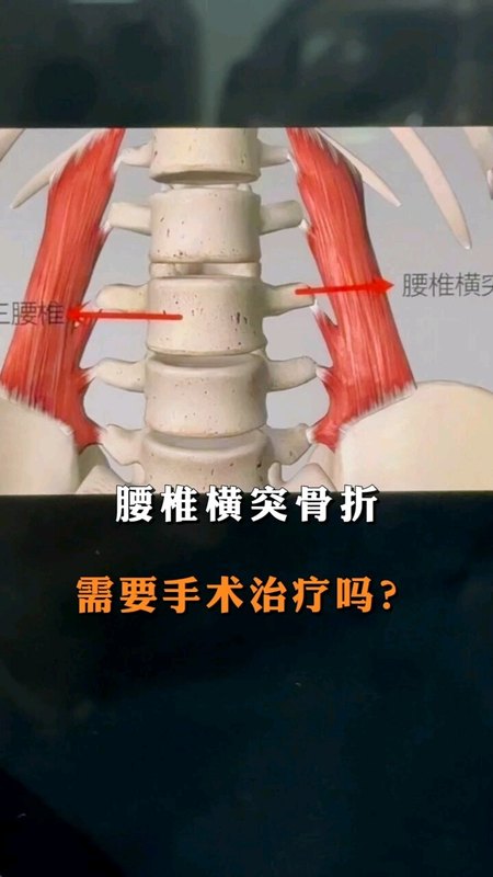 視頻封面