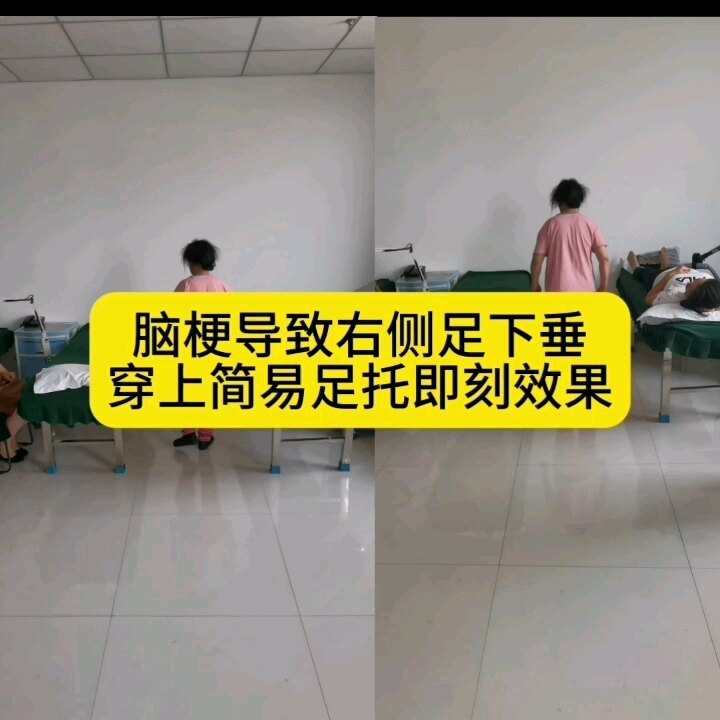 足下垂穿上足托即刻改善