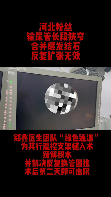 长段、难治性输尿管狭窄怎么办？