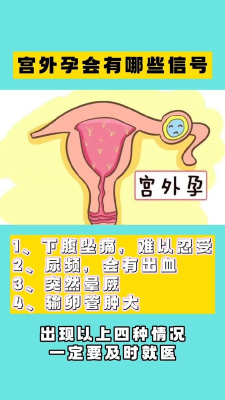 視頻封面