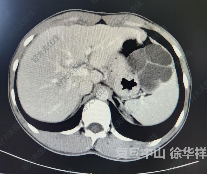 圖文圖片