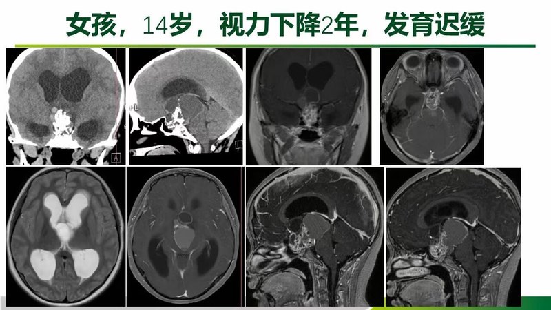 圖文圖片