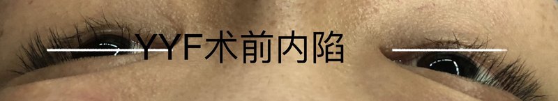 圖文圖片