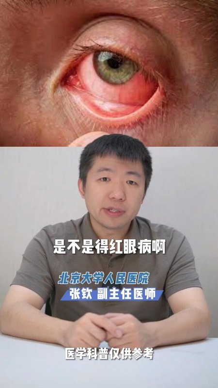红眼病和其他结膜炎有什么不同？定义是啥，怎么鉴别区分？（1/4） ＃红眼病 ＃病毒性结膜炎 ＃腺病毒