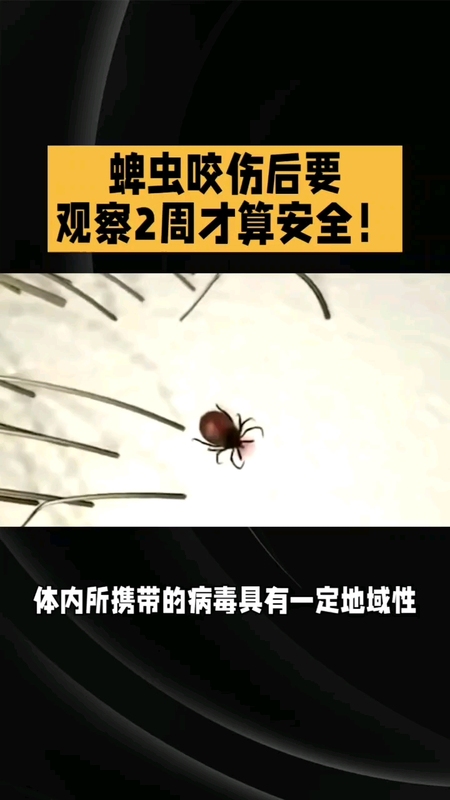 蜱虫咬伤后，要观察多久才算安全？