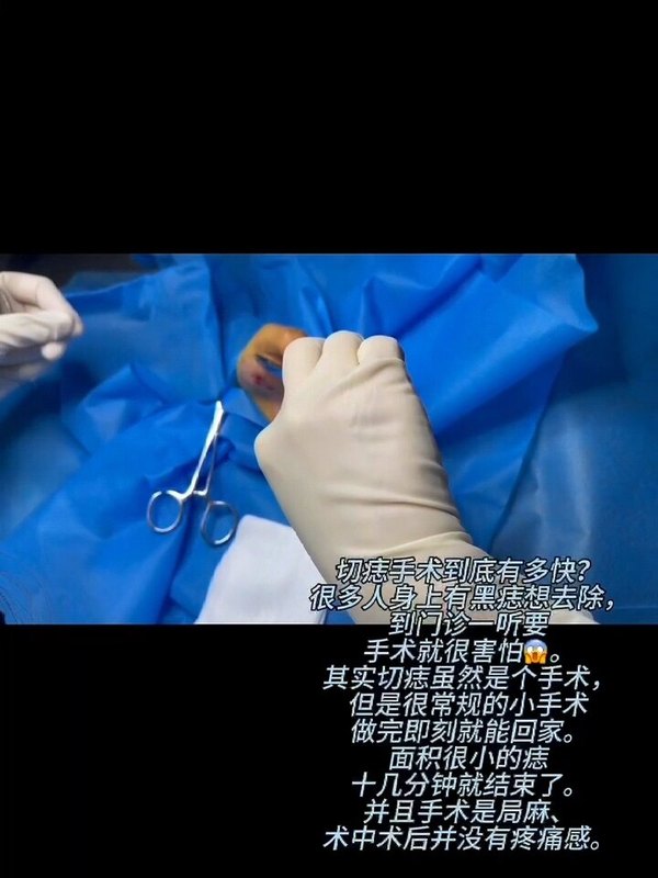 視頻封面
