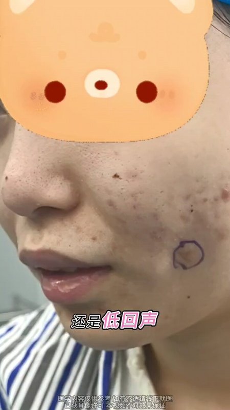 視頻封面