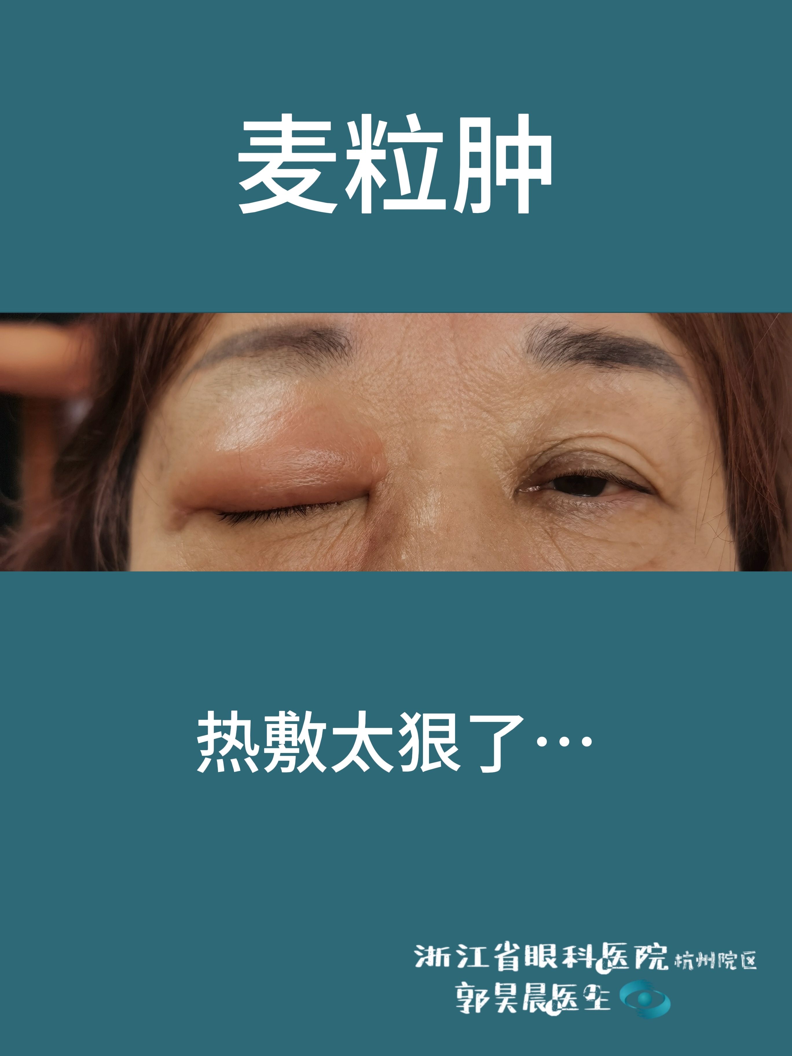 圖文圖片