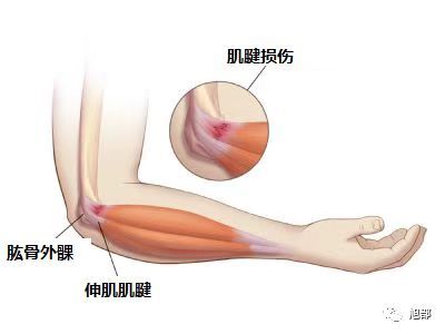 圖文圖片