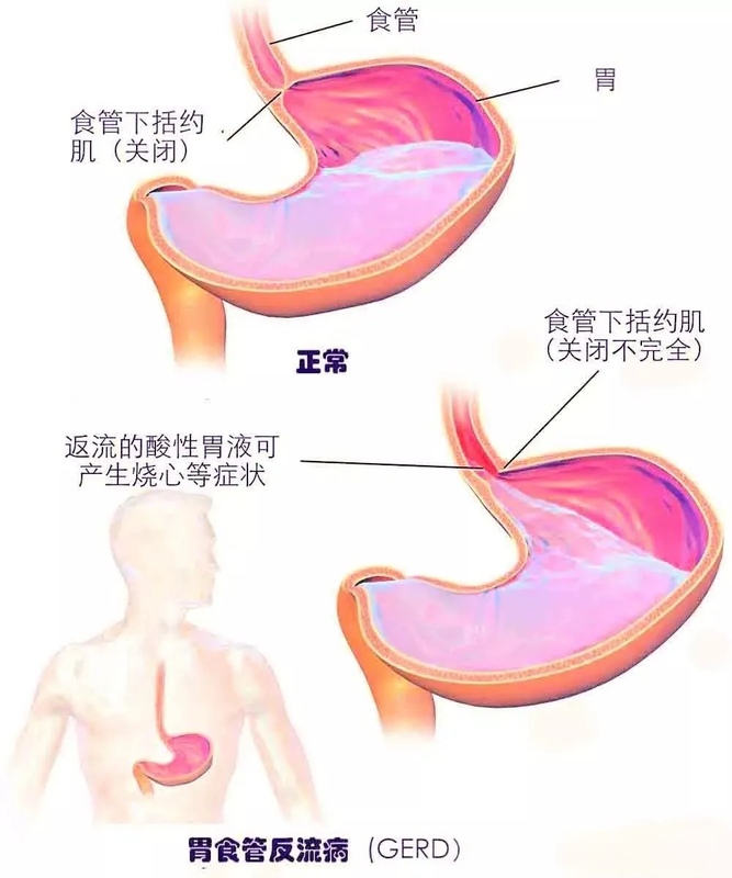 图文图片
