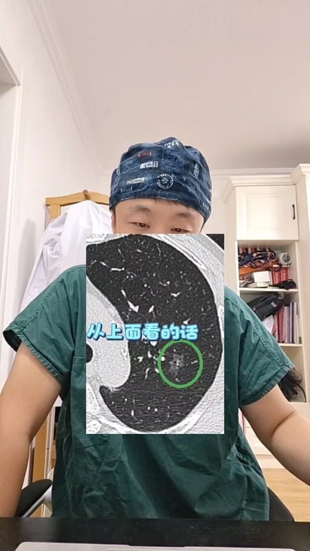 远离焦虑！肺结节并不可怕！大部分是良性的，恶性的手术也可以治