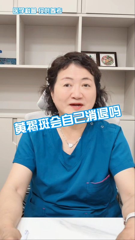 黄褐斑会自己消退吗