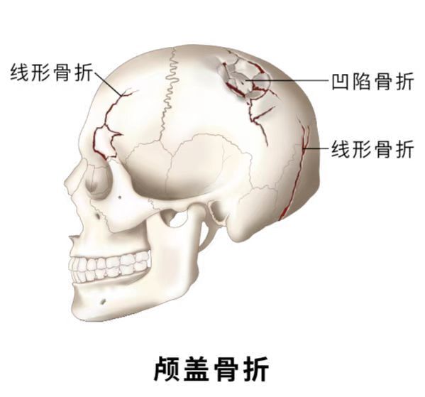 圖文圖片