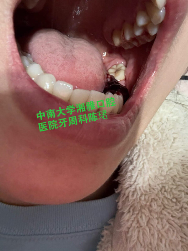 圖文圖片