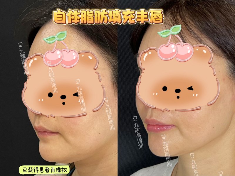 圖文圖片