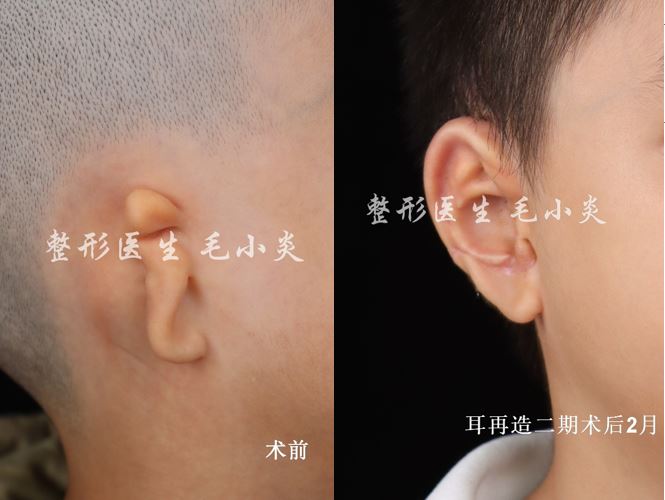 圖文圖片