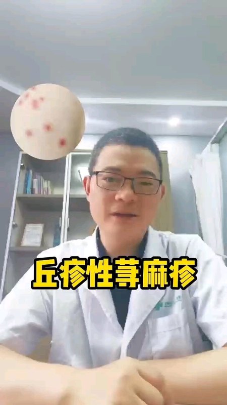 丘疹性荨麻疹