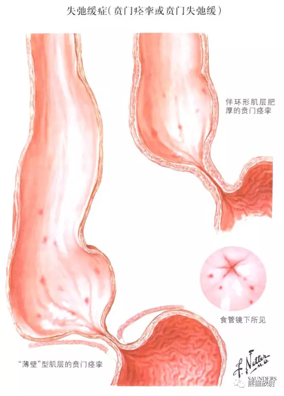 圖文圖片