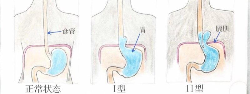 圖文圖片