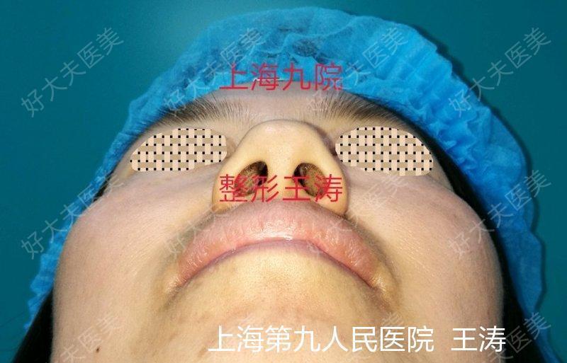 圖文圖片