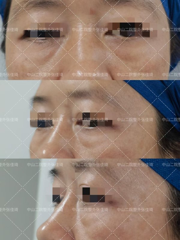 圖文圖片