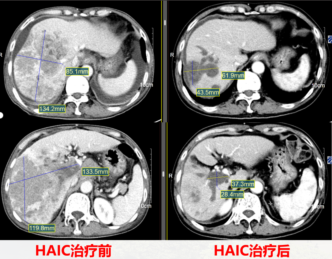圖文圖片