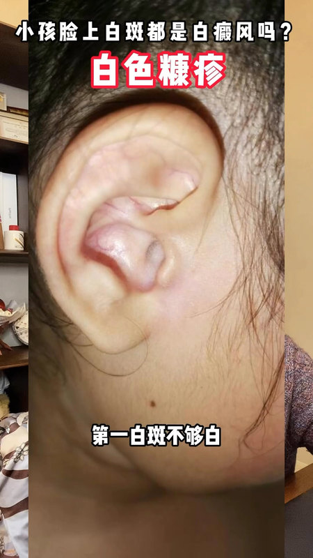 視頻封面