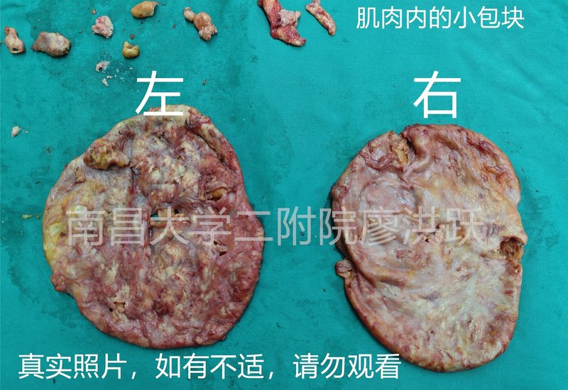 圖文圖片