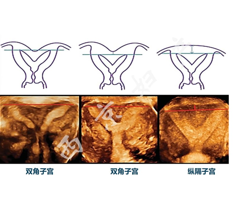 圖文圖片
