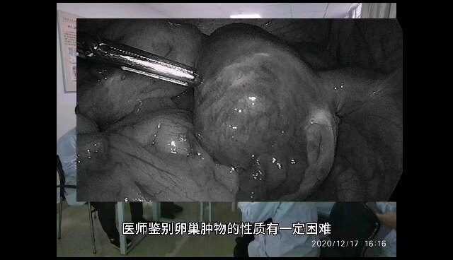 視頻封面