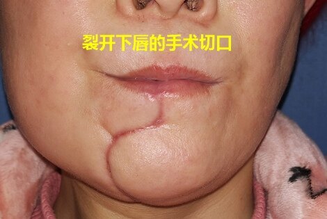 圖文圖片
