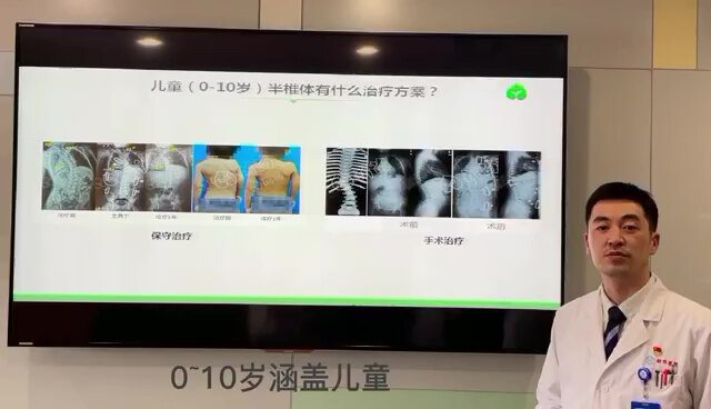 半椎体