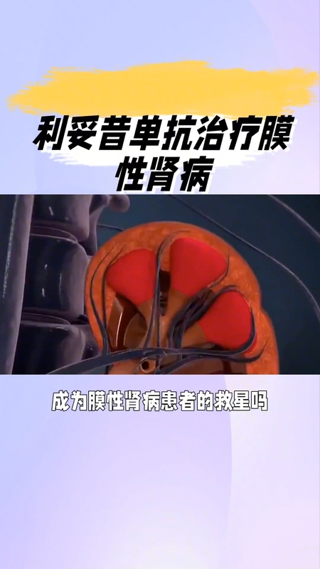 利妥昔单抗治疗膜性肾病