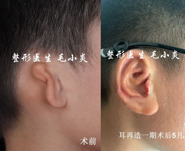 圖文圖片