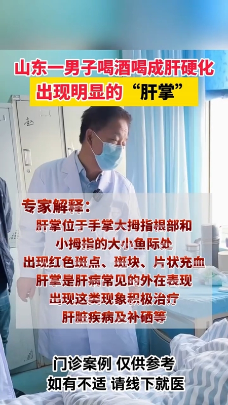 喝酒喝成肝硬化，出现明显的肝掌。