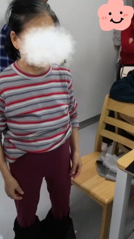 辛苦一辈子有腰椎滑脱的农村老太太，一身病做手术安全吗？效果好吗？术后一个月能恢复多好呢？