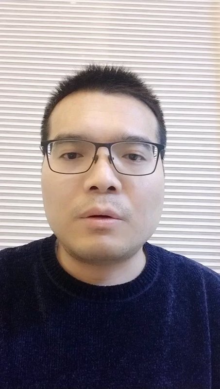 腓骨肌萎缩症遗传给男孩还是女孩