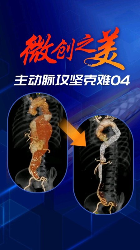 視頻封面