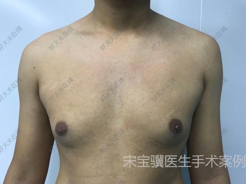 圖文圖片